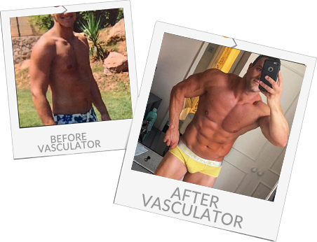 Ali Before and After Vasculator