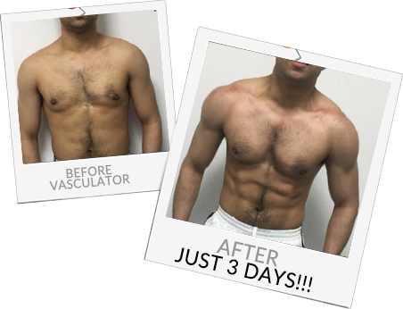 Before and After Vasculator photos