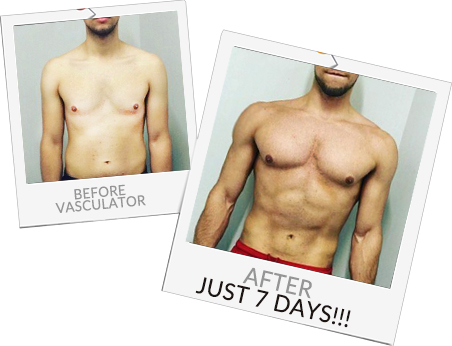 Before and after Vasculator