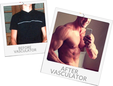 Before and after using Vasculator